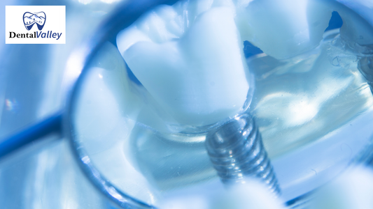 What Makes Cylindrical Implants Ideal for Dental Clinics & Labs