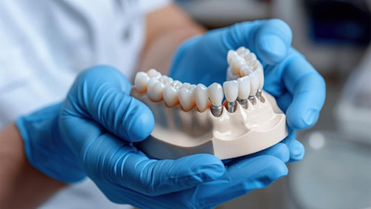 A Comprehensive Guide to Successfully Integrating Dental Implants into Your Practice