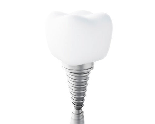 SIVA Sinus Stopper Implant: A Superior Choice for Patients with Limited Bone Volume