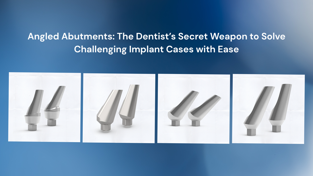 Angled Abutments: The Dentist’s Secret Weapon to Solve Challenging Implant Cases with Ease