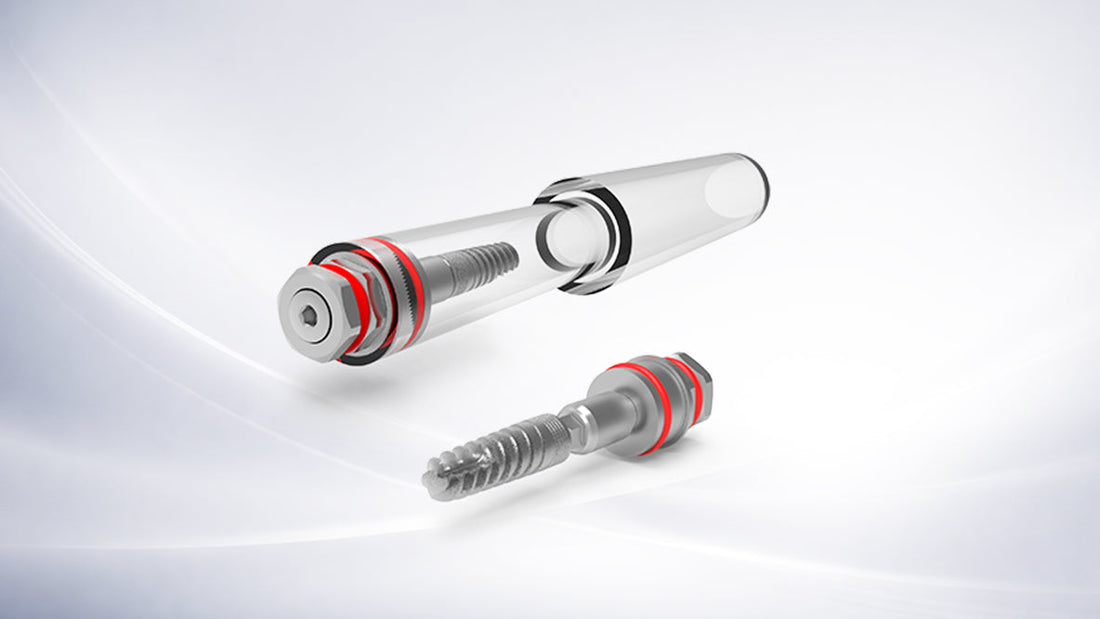 Top Questions Dentists Ask Before Buying Dental Implants Online